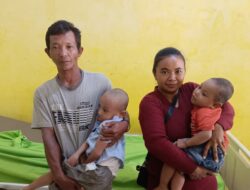 Di Lampung Utara Kakak Beradik Alami Gizi Buruk, Ayah Harapkan Bantuan Dermawan